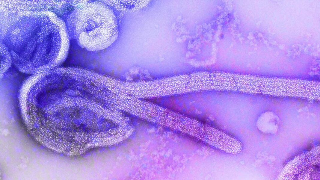 Electron microscopic image of the 1976 isolate of Ebola virus.